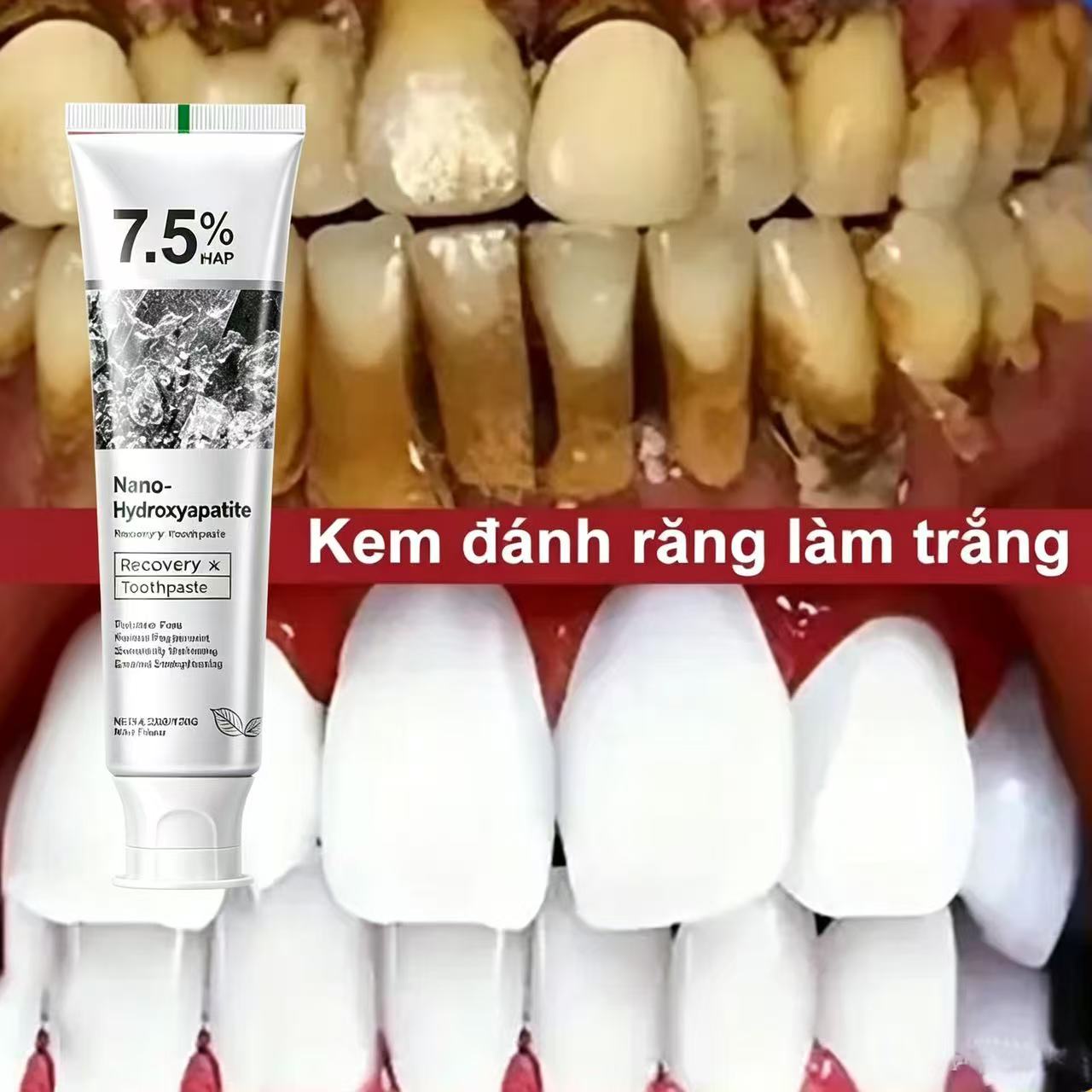 Hydroxyapatite Toothpaste - Dentifrice blanchissant probiotique à 7,5 %