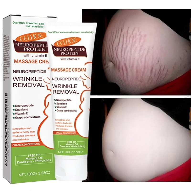 Teeth Whitening Pregnancy - Crème anti-vergetures permanente 100g pour femmes