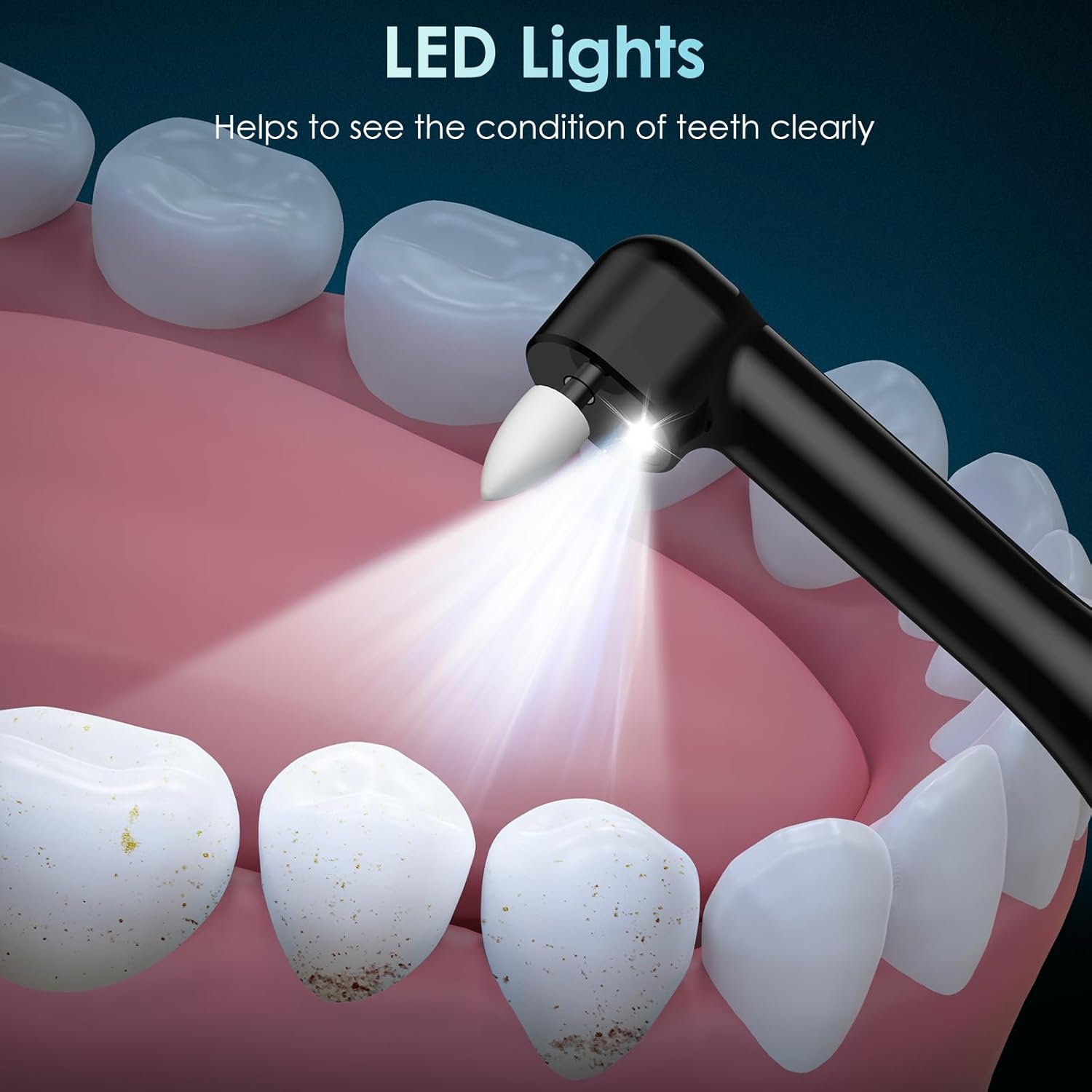 Polisseuse à dents rechargeabl - Teeth Whitening Or Tooth Whitening avis et prix