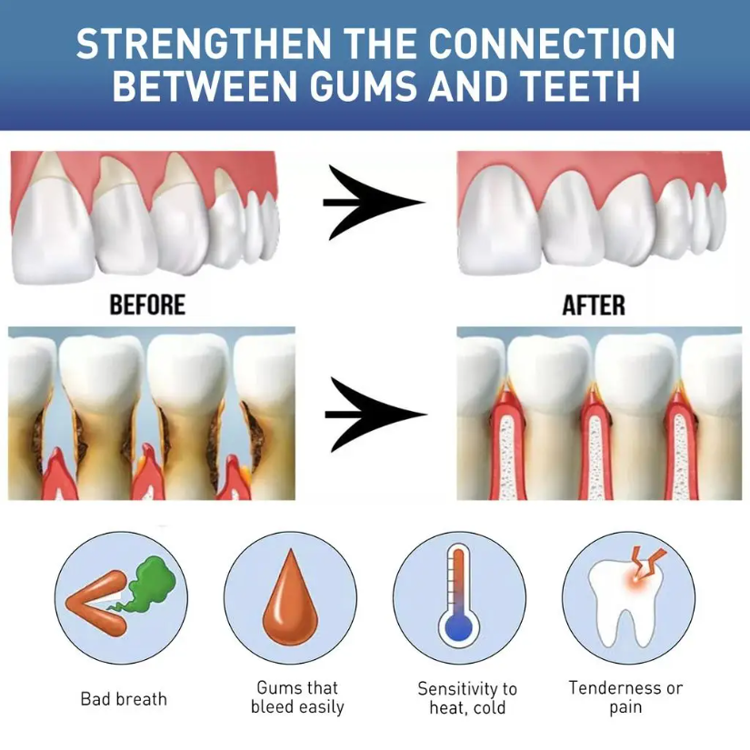 Liquide naturel pour soins buc - Teeth Whitening Natural avis et prix