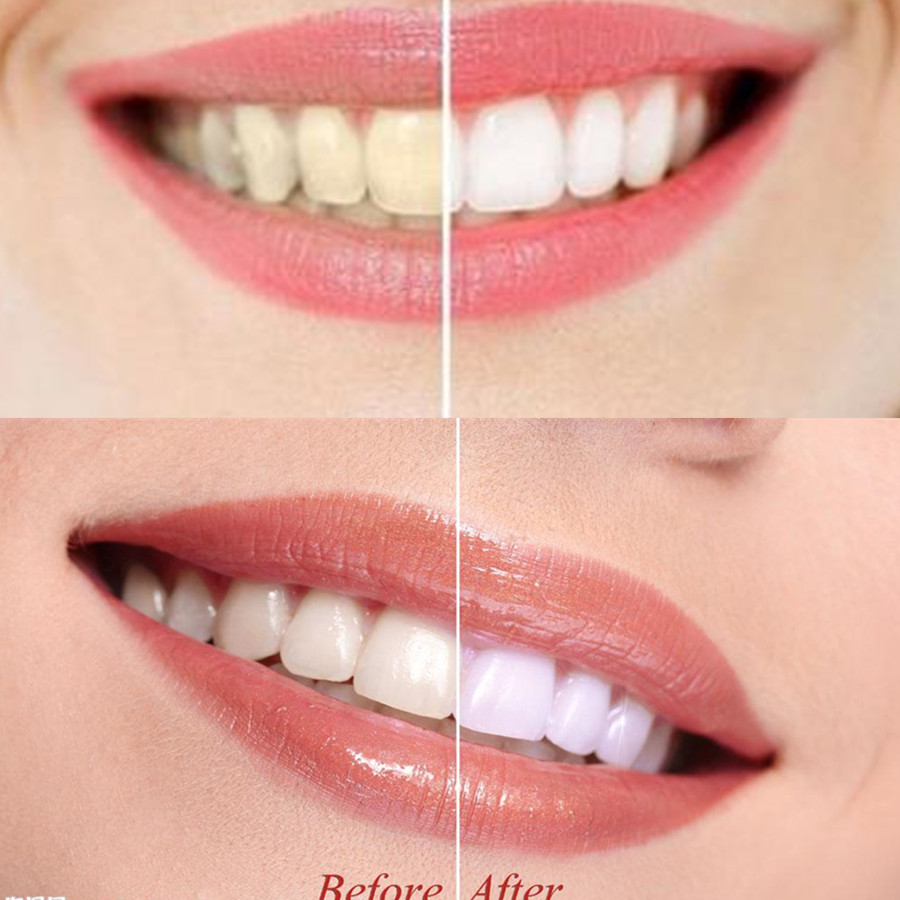 Poudre de charbon de bambou po - Teeth Whitening Zimba avis et prix