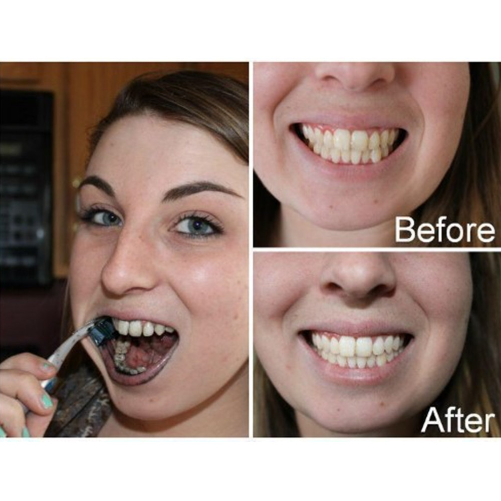 Poudre de charbon de bambou po - Teeth Whitening Zimba avis et prix