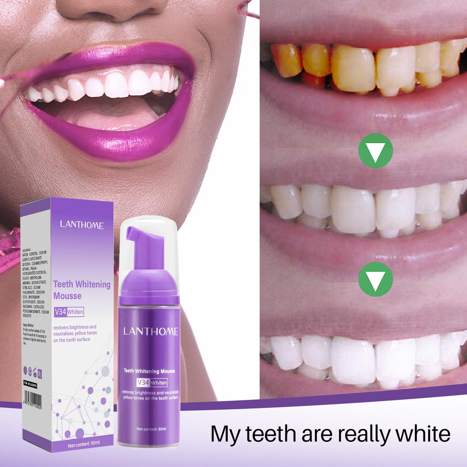 V34 Mousse nettoyage des dents - Teeth Whitening Mousse avis et prix
