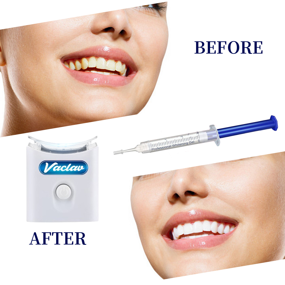 Seringue de Gel de blanchiment - Teeth Whitening Kit At Home avis et prix