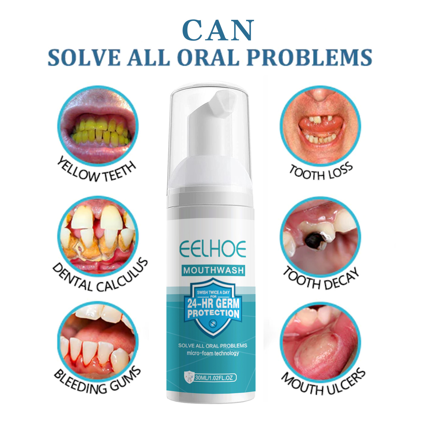 EELHOE blanchiment des dents n - Teeth Whitening Mousse avis et prix