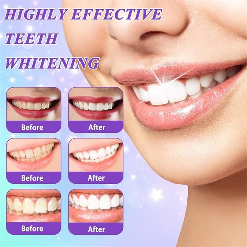 Mousse dentifrice blanchissant - Teeth Whitening Mousse avis et prix