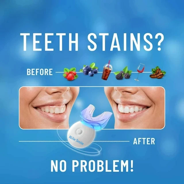 Kit de blanchiment dentaire sa - Teeth Whitening Kit At Home avis et prix