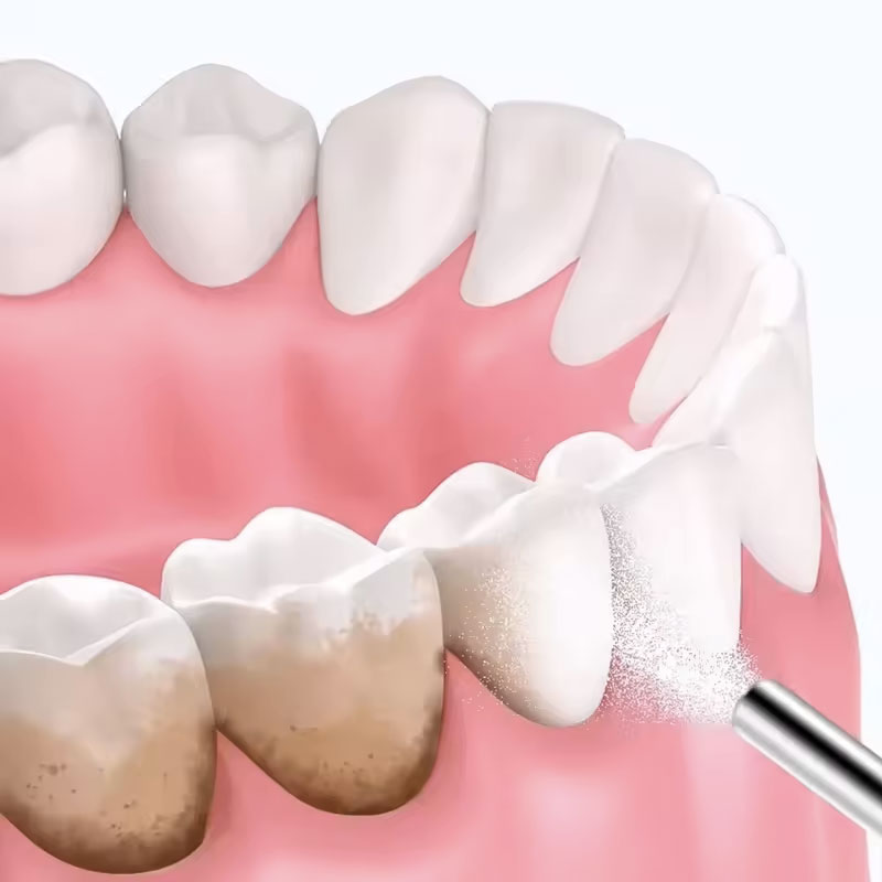Poudre de sablage dentaire 130 - Teeth Whitening Zimba avis et prix