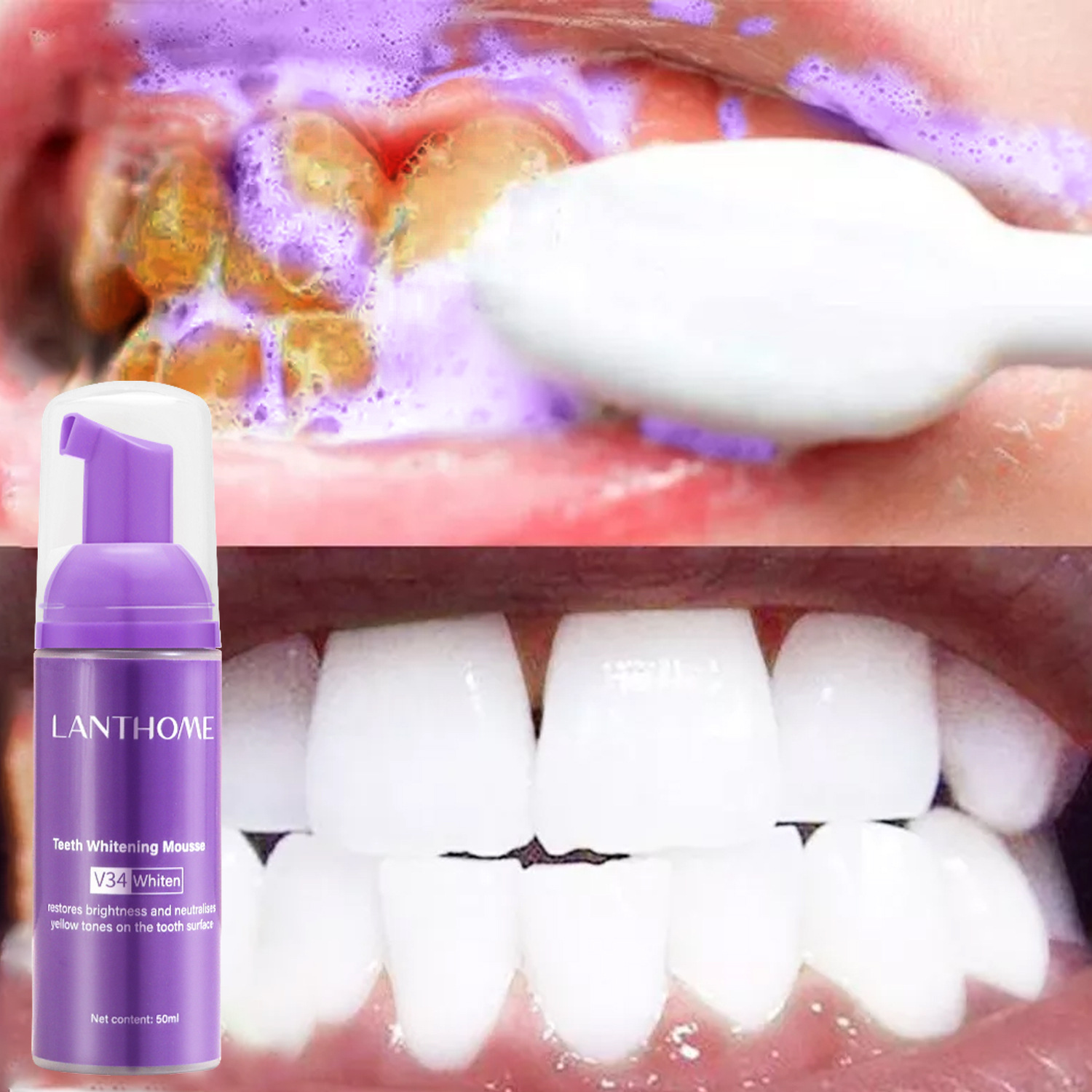 Mousse de blanchiment des dent - Teeth Whitening Mousse avis et prix