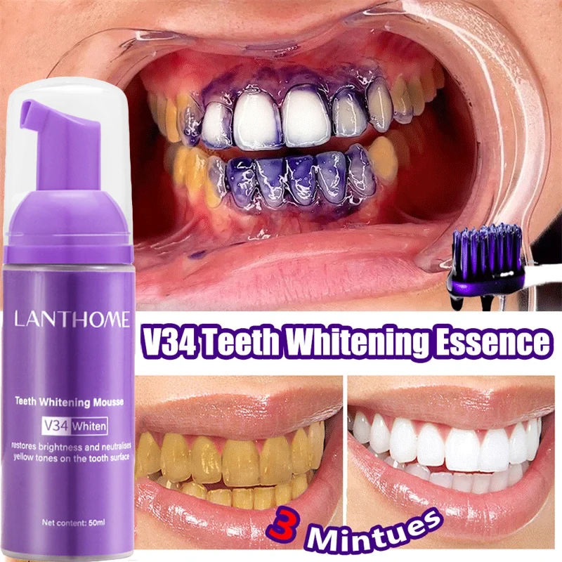 Mousse de blanchiment des dent - Teeth Whitening Mousse avis et prix