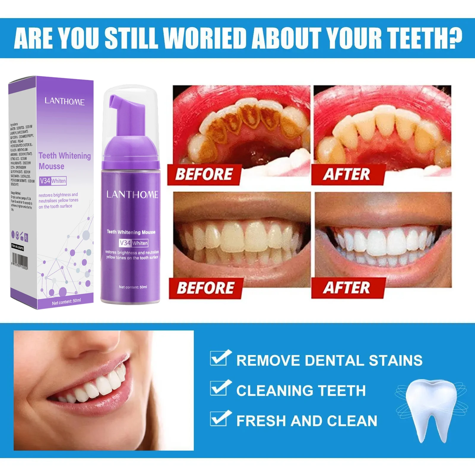 Mousse de blanchiment des dent - Teeth Whitening Mousse avis et prix