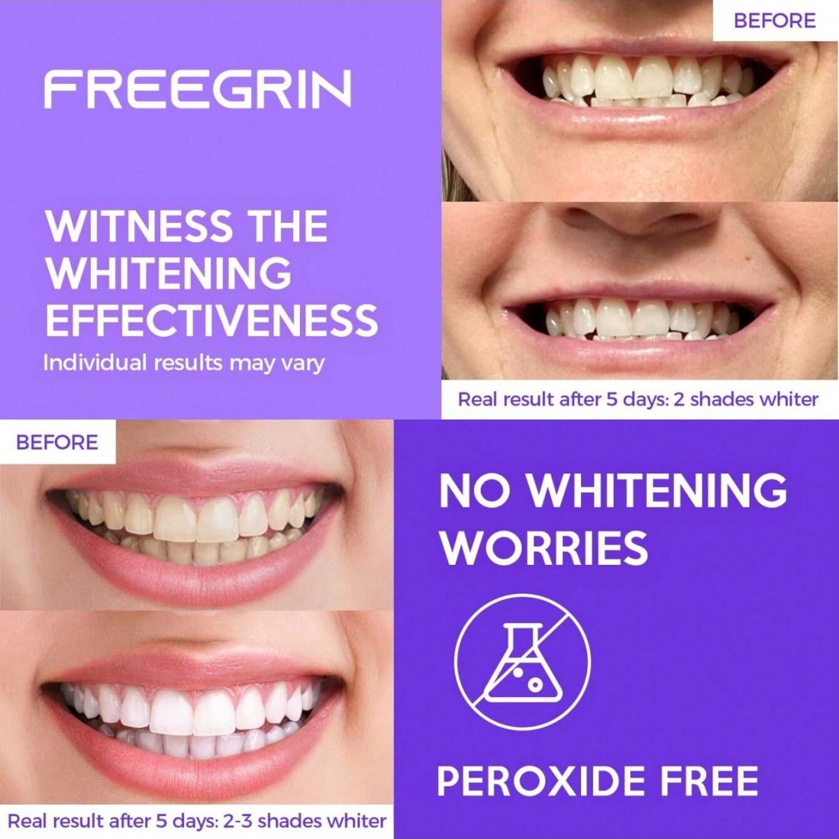 Autocollants de blanchiment de - Teeth Whitening Gels Used By Dentists avis et prix