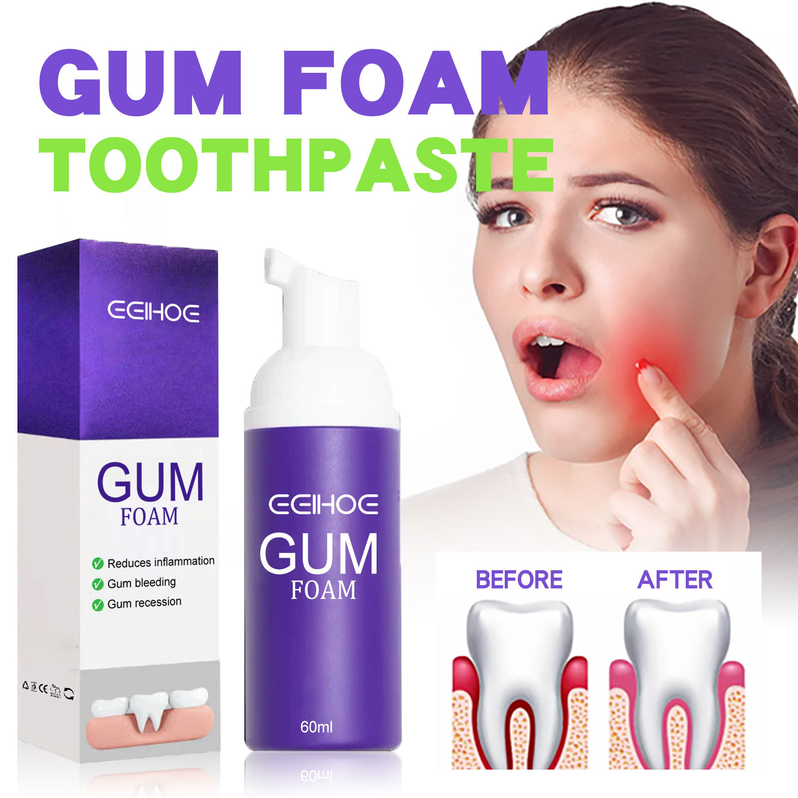 Mousse de blanchiment des dent - Teeth Whitening Mousse avis et prix