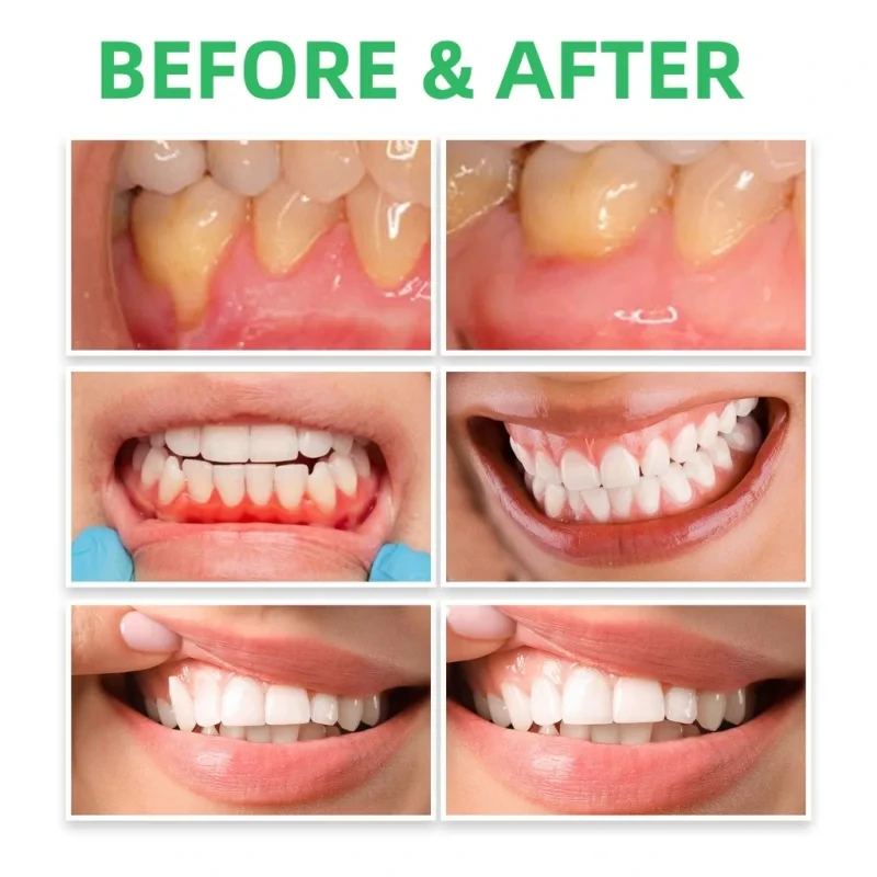 Gouttes de Réparation de Gomme - Teeth Whitening Paste avis et prix