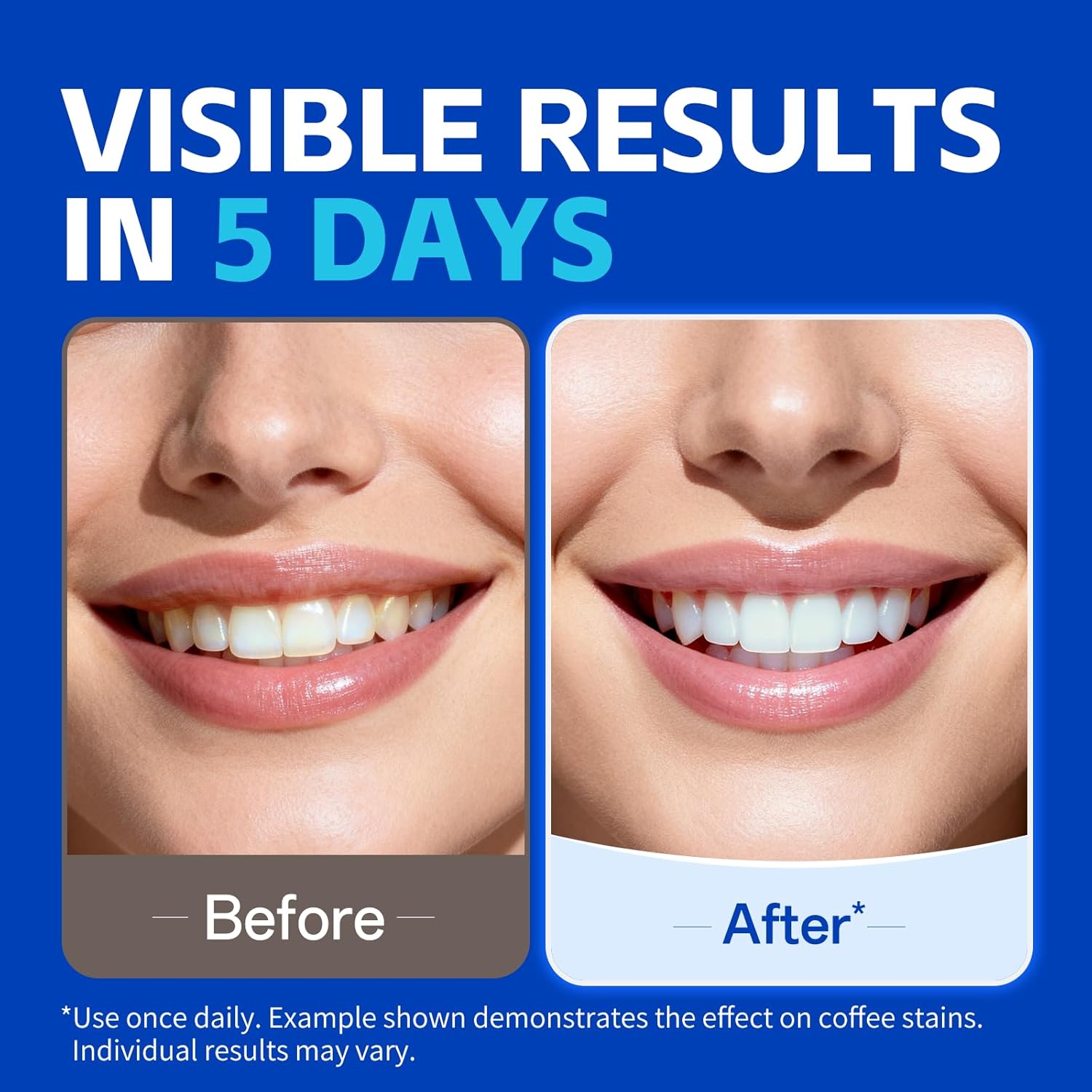 Bandes blanchissantes pour les - Teeth Whitening Oil Pulling avis et prix