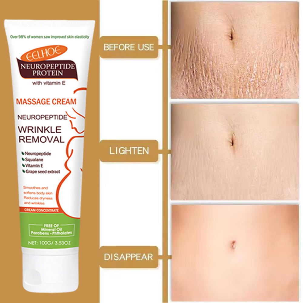 Crème anti-vergetures permanen - Teeth Whitening Pregnancy avis et prix